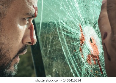 Surviving An Injury. Latino Man With Wound Injury Looking Through Broken Glass. Hispanic Man Bleeding From Head Injury. Handsome Injured Guy With Skin Deep Injury.