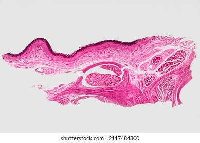 Sweat Gland Of Human Skin, Microscope Slide. 