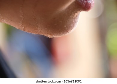 Sweaty Face Concept, Close Up Of Woman With Wet Skin On Chin With Blurred Background.