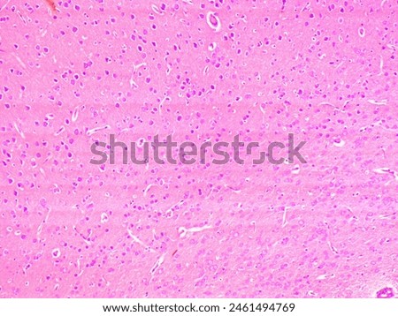 T S Microscopy of brain 