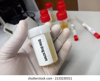 Tab technician holds Urine drug screen test sample, also known as a urine drug screening painless test it analyzes your urine for the presence of certain illegal drugs and prescription medications