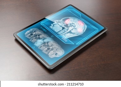 Tablet displaying cerebral activity