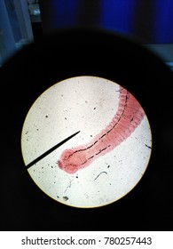 Taenia Saginata Beef Tapeworm