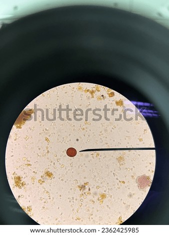 Taenia solium egg in stool