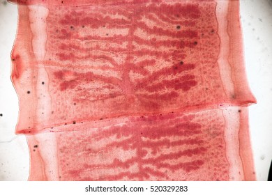 digestion Dominant Prestige 434 Pork Tapeworm Images, Stock Photos & Vectors | Shutterstock