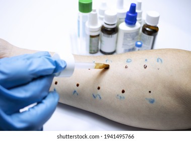 taken an allergy test in a forearm - Shutterstock ID 1941495766