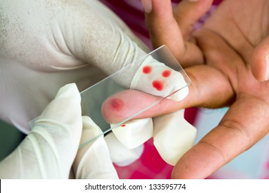 Taken Blood Films For Malaria Parasite On Fingers