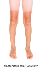 Tan Lines On A Child's Legs