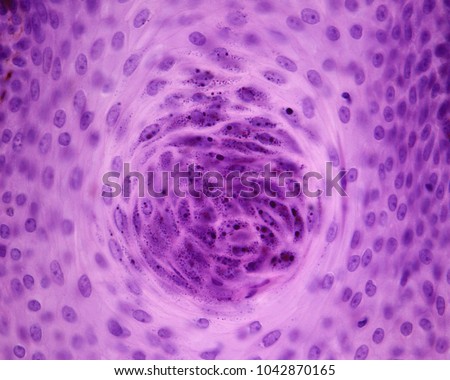 Tangential section of the granular layer or stratum granulosum of a squamous stratified epithelium, showing the keratohyalin granules typical of this layer.