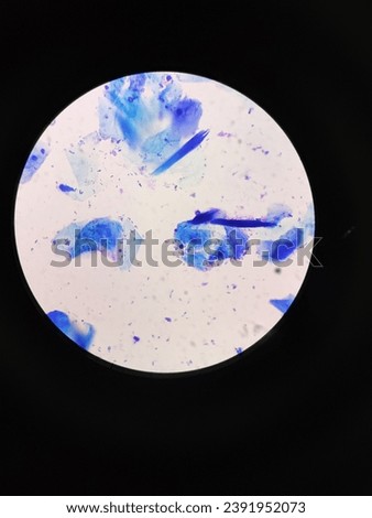 tape smear shows the keratinocytes and rod shape bacteria