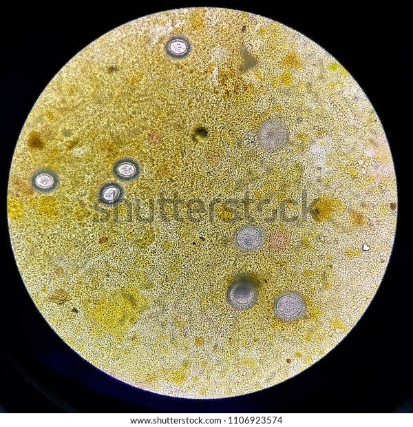 Tapeworm Parasite >> Tapeworm Parasite Microscope Stock Photo Edit Now 1106923574 Tapeworm Parasite >> Tapeworm Parasite Microscope Stock Photo Edit Now 1106923574