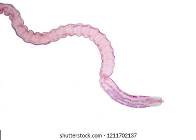 Tapeworm (Parasitic flatworm) of cattle and other grazing animals under the microscope for education.