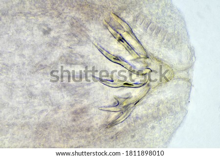 Tapeworm scolex under the microscope