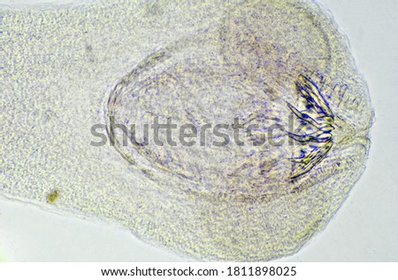 Tapeworm scolex under the microscope