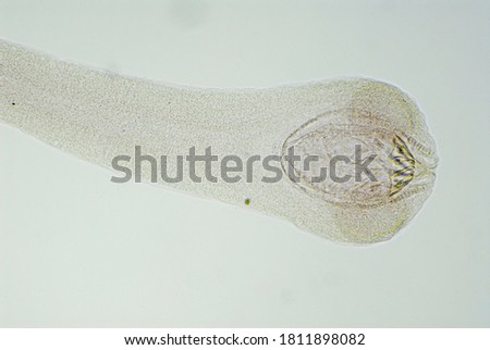 Tapeworm scolex under the microscope