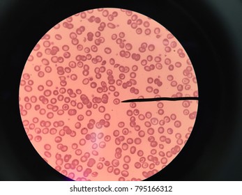 Target cell from human blood