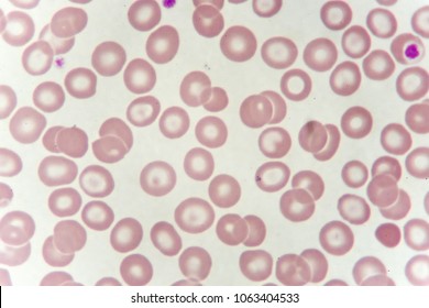 975 Peripheral blood smear Images, Stock Photos & Vectors | Shutterstock