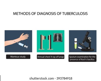 TB diagnostic methods. X-rays of light. Mantoux test. Examination of sputum. World Tuberculosis Day. Infographics. illustration on isolated background.