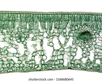 Tea Plant. Cross Section Of A Camellia Leaf, That Show Their General Internal Structure (cuticle, Palisade Parenchyma, Spongy Parenchyma, Vascular Bundles, Epidermis). 