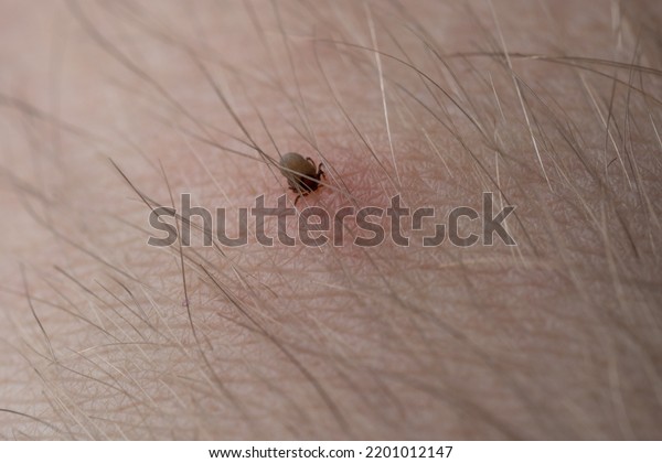 Teak with its\
chelicerae adhering to human\
skin.