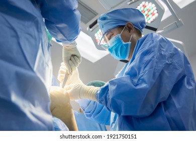 Team of doctor in blue surgical gown suit working inside modern operating room.Surgeon perform total knee replacement surgery in osteoarthritis patient with protective glasses.Medical concept.