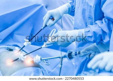 Team of doctor did laparoscopic cholecystectomy inside operating room in hospital.Surgeon hold medical instrument or surgical equipment in minimal invasive endoscopic surgery with light effect.