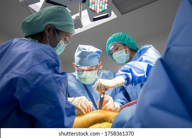 Team Of Doctor Doing Surgery Inside Modern Operating Room With Orange Effect. Asian Orthopedic Surgeon In Blue Surgical Gown Suit Under Surgical Lamp.Fracture Fixation Was Done In Car Accident Patient