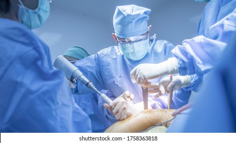 Team Of Doctor Doing Surgery Inside Modern Operating Room With Orange Effect. Asian Orthopedic Surgeon In Blue Surgical Gown Suit Under Surgical Lamp.Fracture Fixation Was Done In Car Accident Patient