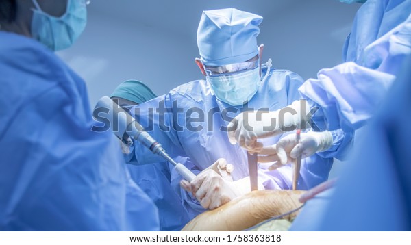 Team of doctor doing surgery inside modern\
operating room with orange effect. Asian orthopedic surgeon in blue\
surgical gown suit under surgical lamp.Fracture fixation was done\
in car accident patient