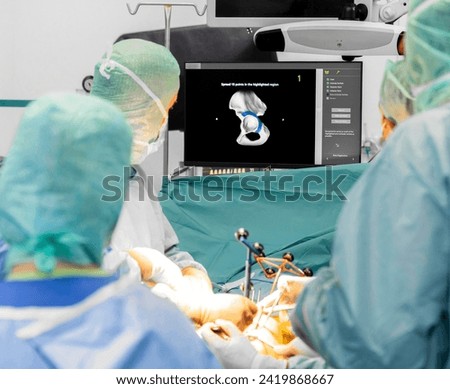 Team of doctor perform total hip arthroplasty replacement surgery in osteoarthritis patient inside the operating room. robot-assisted - robotic hip and knee replacement surgery	
