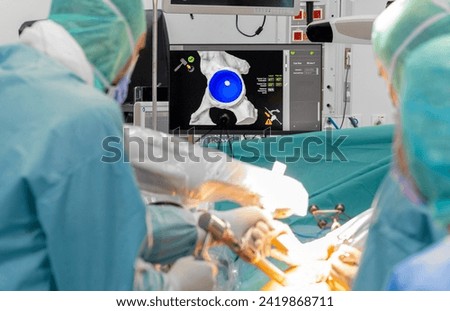 Team of doctor perform total hip arthroplasty replacement surgery in osteoarthritis patient inside the operating room. robot assisted robotic hip and knee replacement surgery	