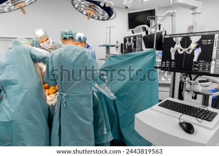 Team of doctor perform total hip arthroplasty replacement surgery in osteoarthritis patient inside the operating room. robot assisted robotic hip and knee replacement surgery	