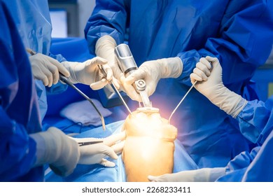 Team of orthopedic doctor in blue sterile uniform doing total knee joint arthroplasty.Knee replacement surgery is done by surgeon inside operating room in hospital.Selective focus with light effect. - Shutterstock ID 2268233411