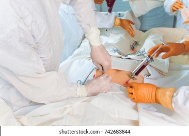 team  surgeons operation bone marrow transplant 