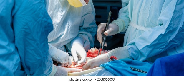 A Team Of Surgeons Performs A Surgical Operation. Selective Focus On The Hands Of Surgeons In Sterile Gloves With A Surgical Instrument During The Operation. Widescreen Image.