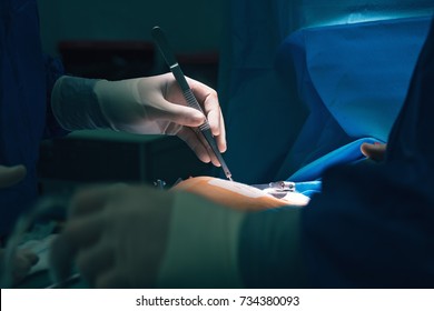 Team Of Surgeons Using Electric Cautery And Clamps For Minithoracotomy Intervention Close-up, Open Cord Heart Surgery Minimally Invasive Surgery. Open Heart Details