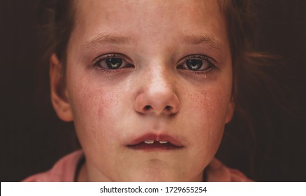 Tears in the eyes of a child. The girl is crying and a tear runs down her cheek. Close-up. - Powered by Shutterstock