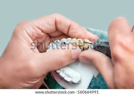 Technical shots of model on a dental prothetic laboratory. Dentist hands with plaster model, electric burr and ceramic dentures Stock foto © 