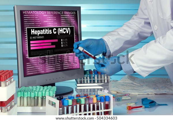 technician with blood sample in\
screen with software of analysis laboratory / test of Hepatitis C\
(HCV). technician in lab examining blood sample with results in\
computer 