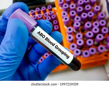 Technician hold blood sample for ABO blood grouping.