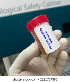 Technician Holding Stool Sample For Severe Acute Respiratory Syndrome Test. Viral Disease.