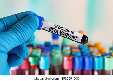 Technician holding tube of blood test identified with the label Covid-19 BETA Variant. Doctor with a positive blood sample for the new variant detected of the coronavirus strain called BETA