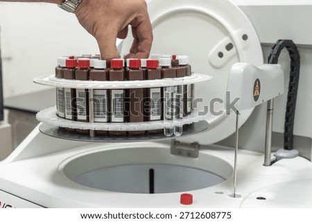 A technician places a rack of barcoded sample vials into an automated laboratory analyzer for clinical testing.