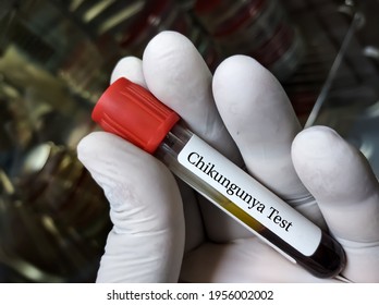 Technologist Or Doctor Holding Blood Sample For Chikungunya Virus Test,laboratory Background