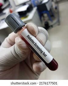 Technologist hold sample tube of Diabetes screening test for diagnosis hyperglycemia or hypoglycemia, type 1 and type 2 diabetes.