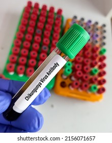 Technologist Holding Blood Sample For Chikungunya Virus Antibody Test, Laboratory Background