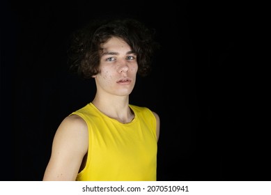 Teen Boy With Acne And Blackheads On His Face On A Dark Background. The Guy Is Handsome But Pimples Spoil His Appearance And Mood, He Is Often Sad