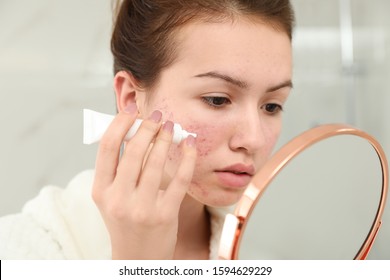 Teen Girl With Acne Problem Applying Cream Using Mirror In Bathroom