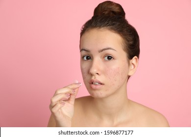 Teen girl applying acne healing patch on light pink background