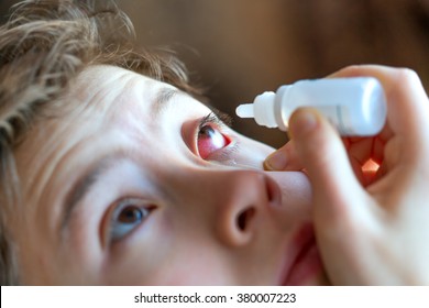 Teen Girl Drips Into Patient Eye foto de stock (editar ahora) 380007223